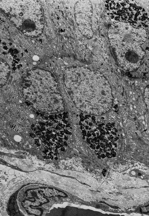 view Pigmented epithelium - TEM