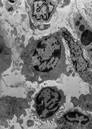 view Plasma cell, lymphocyte and fibroblast