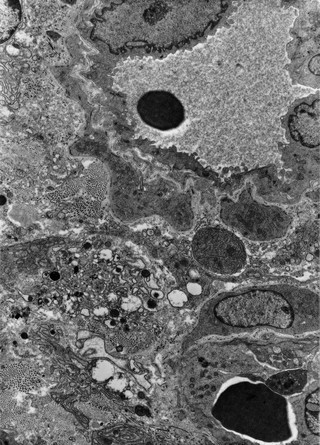 Cell death around scleral blood vessels