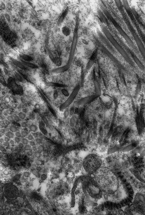 view Intercellular matrix degradation