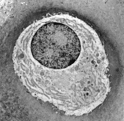 Chondrocyte showing organelles