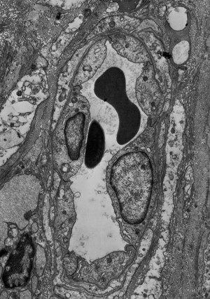 view Capllary in the corneal stroma
