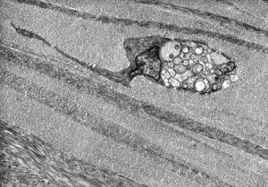 view Nerve fibre in corneal stroma