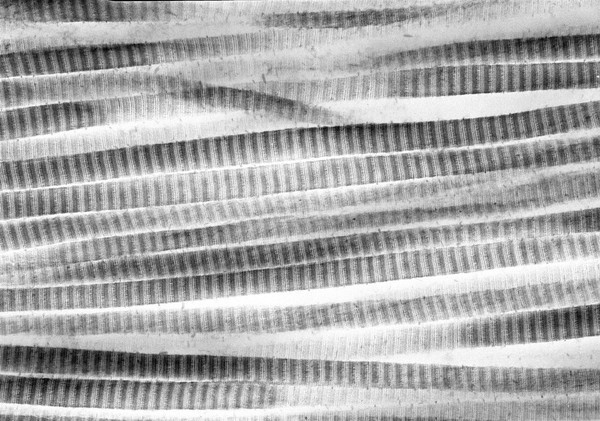 Collagen fibrils