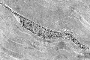 view Keratocyte in the corneal stroma