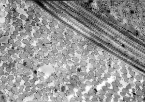 view Collagen fibrils - transverse & longitudinal