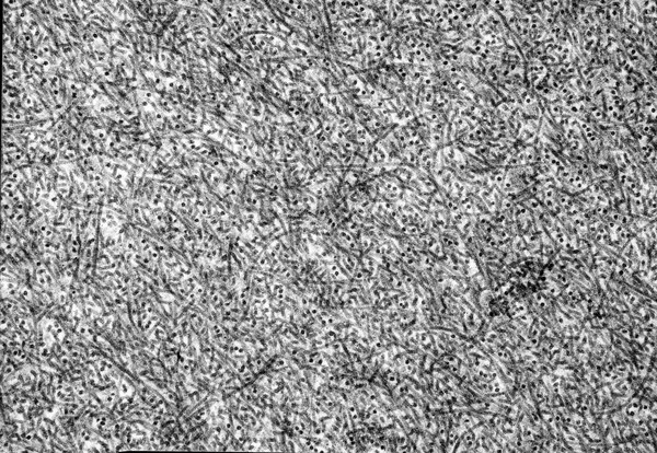 Meshwork of collagen fibrils