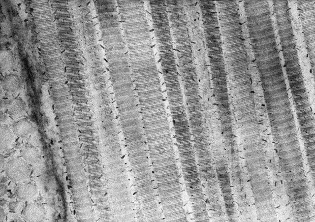 Type I collagen with proteoglycans