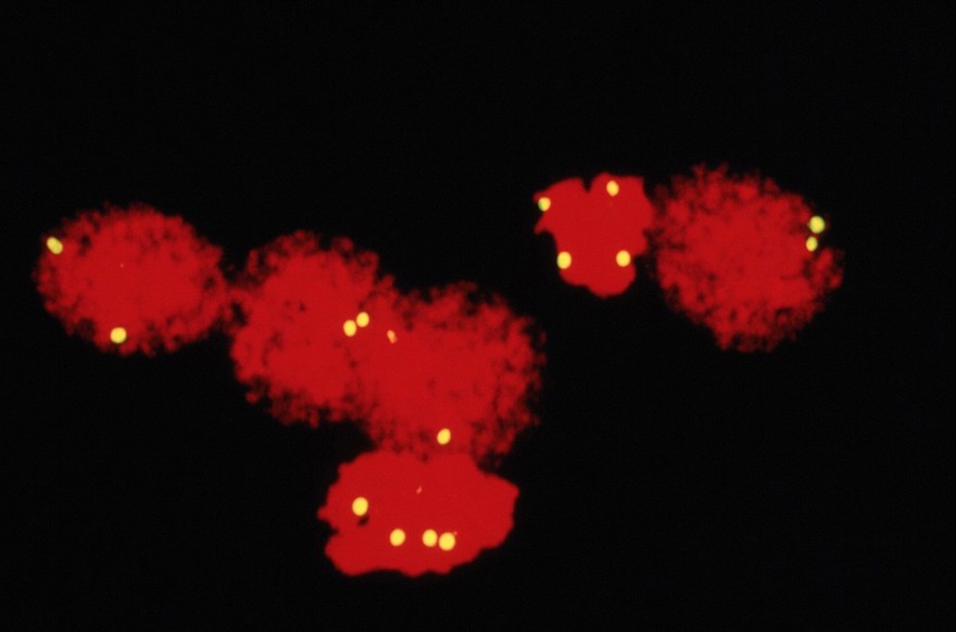 FISH showing chromosome 18