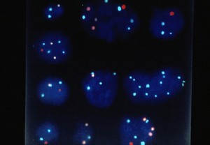 view FISH - abnormalities in embryonic nuclei