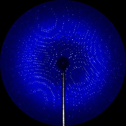 X-ray diffraction pattern of the enzyme glutamate