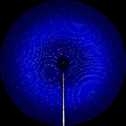 X-ray diffraction pattern of the enzyme glutamate