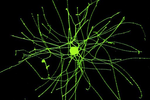 sensory neuron from an adult DRG