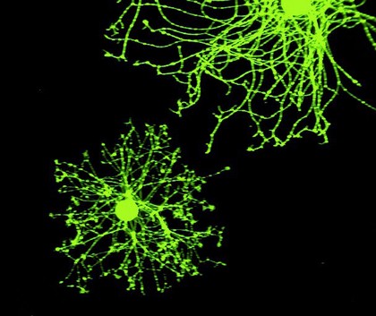 sensory neurons from an adult DRG