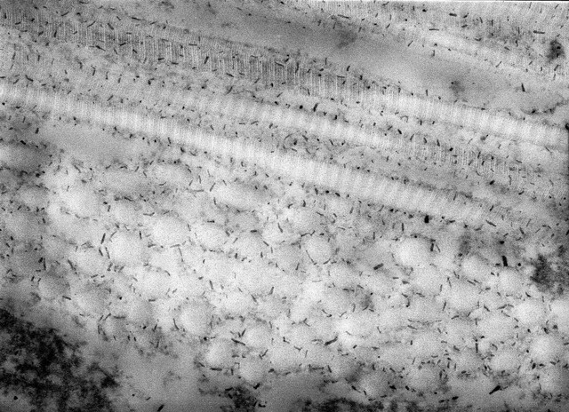 Collagen fibrils with proteoglycans