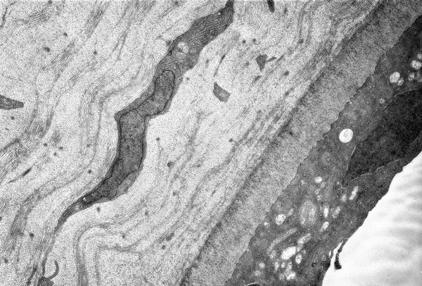 Posterior face of the cornea - TEM