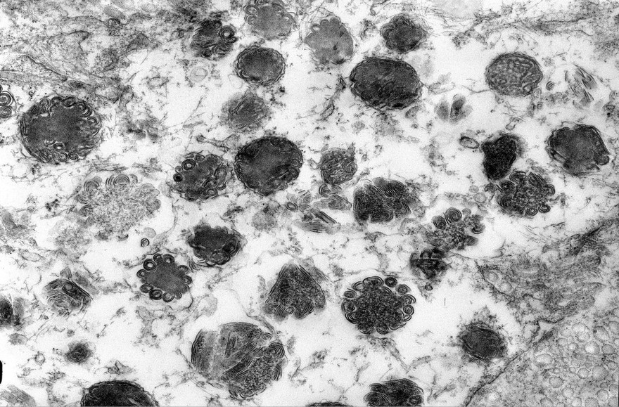 Mast cell granules - scroll-type