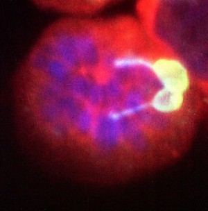 view East Coast fever parasite/cell division