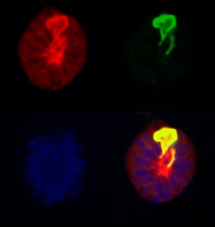 East Coast fever parasite/cell division