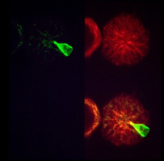 East Coast fever parasite/cell division