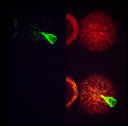 East Coast fever parasite/cell division