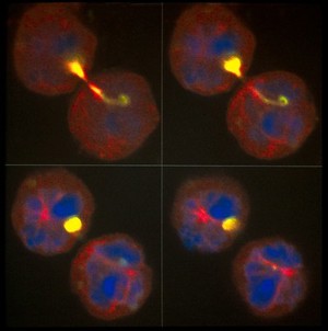 view East Coast fever parasite/cell division