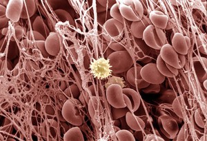 view Electron micrograph of blood clot, high power