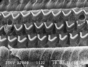 view SEM of outer hair cells in organ of Corti