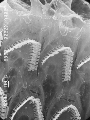 view SEM close-up outer hair cells,organ of Corti