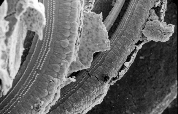 SEM organ of Corti, showing hair cells