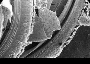 view SEM organ of Corti, showing hair cells