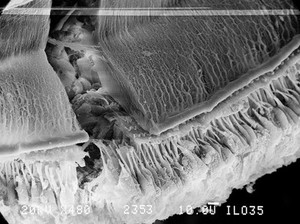 view SEM, section through cochlea of guinea pig