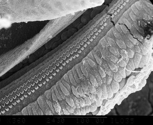 view SEM organ of Corti, showing hair cells