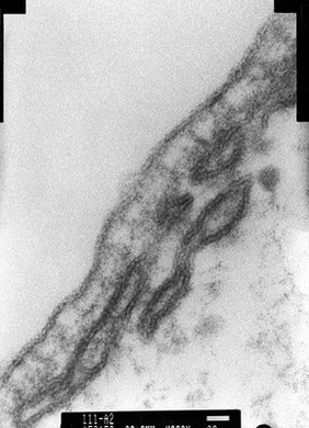 SEM cochlea, showing organ of Corti