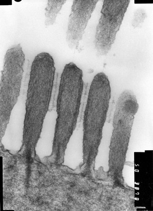 view TEM of stereocilia in guinea pig cochlea