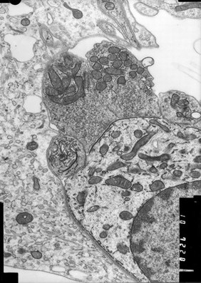 TEM base of hair cell + nerve ending