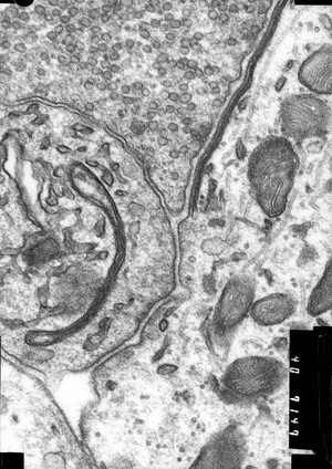 view TEM base of hair cell + nerve ending