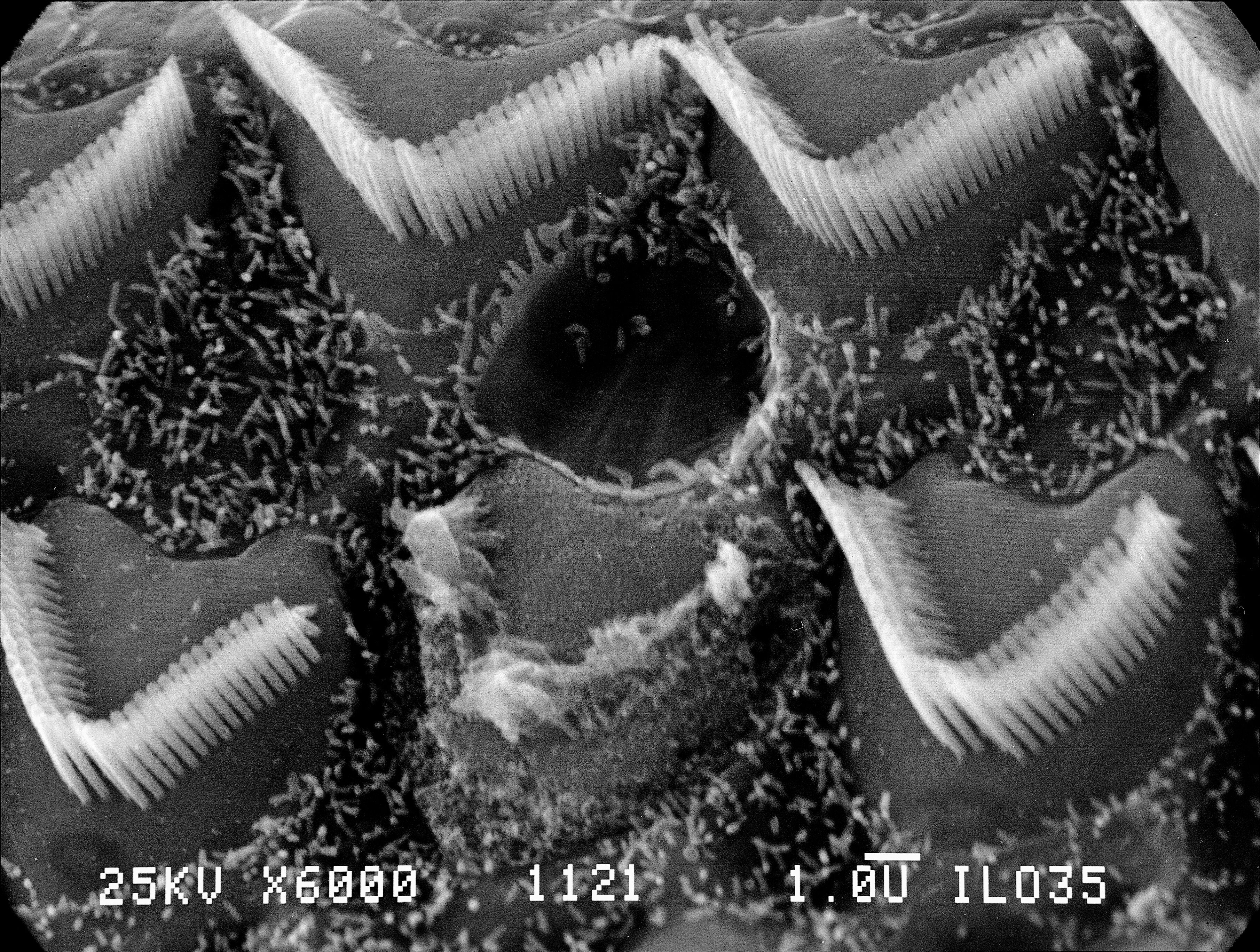SEM outer hair cells, organ of Corti | Wellcome Collection SEM outer hair cells, organ of Corti | Wellcome Collection