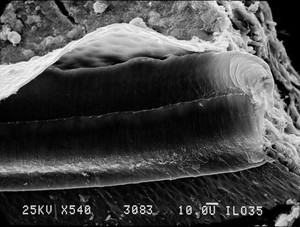 view SEM organ of corti showing rows of hair cell