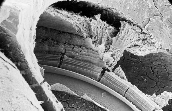 SEM organ of Corti in cochlea