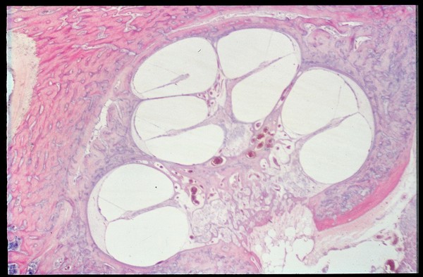 Section through human cochlea