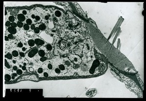 view TEM hair cell of cochlea