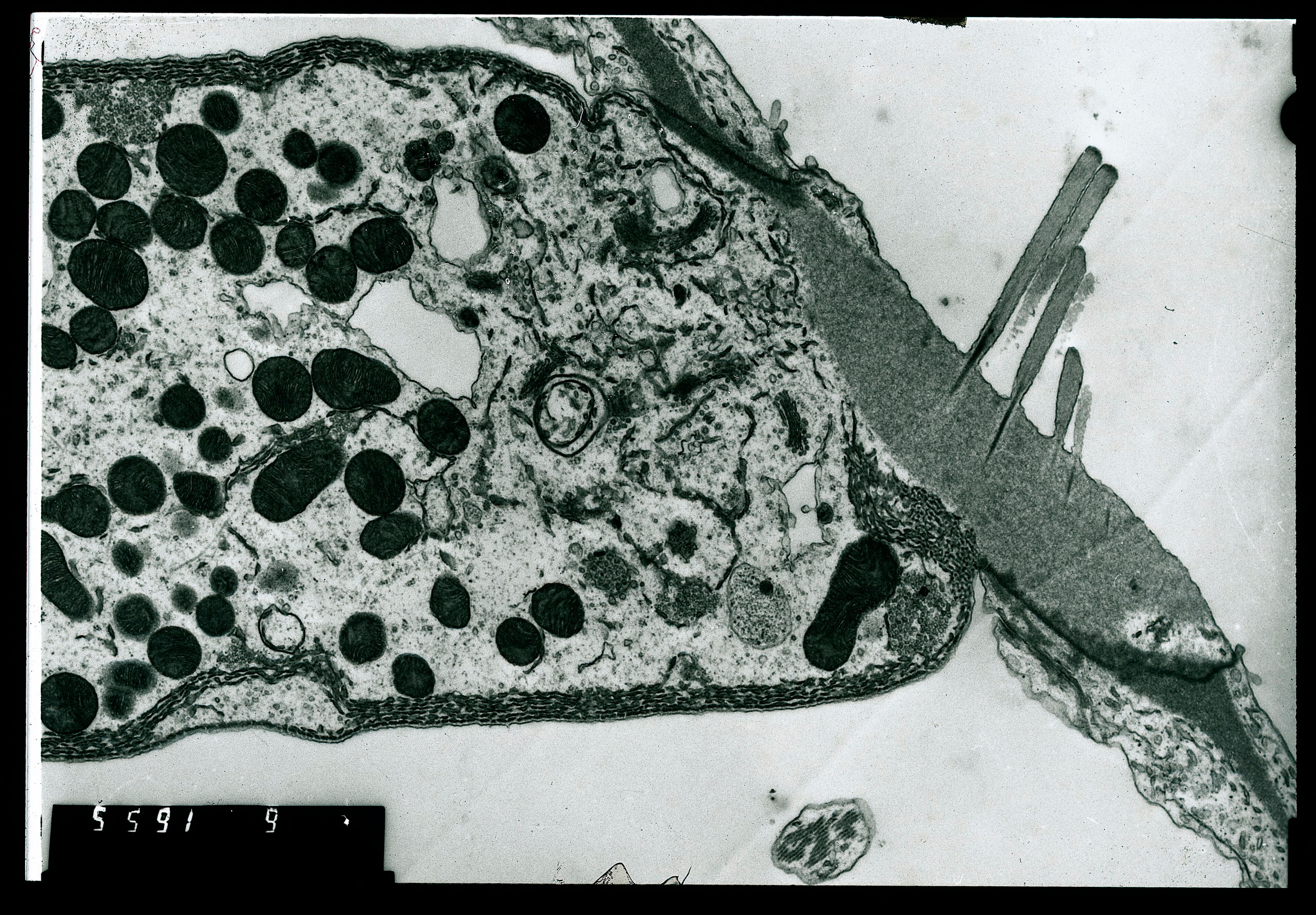 TEM hair cell of cochlea