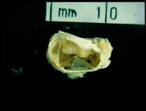 view Section through skull, showing cochlea