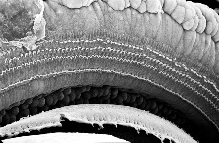 SEM organ of Corti