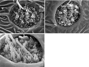 view Fish neuromast organ, composite of 3 images