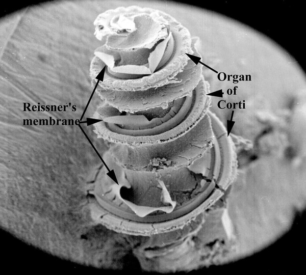 SEM Organ of Corti + labels