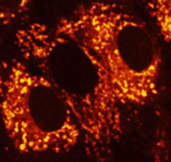 Calcium wave induced by touch. Image made using Zeiss 510 confocal microscope.