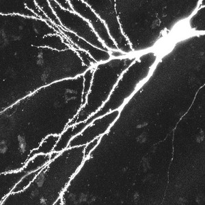 view Confocal image of neurone + dendrites, BW