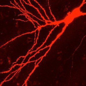 view Confocal image of neurone + dendrites